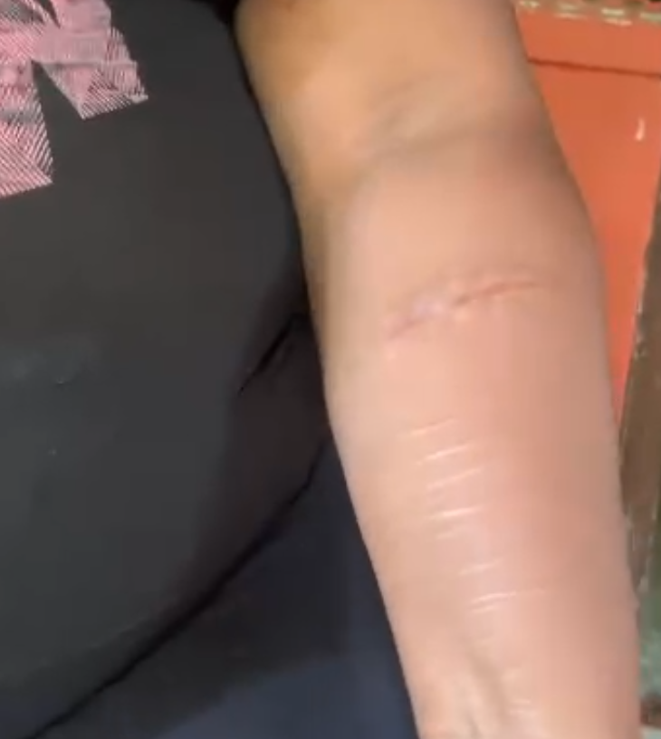 Imágen de la persona afectada