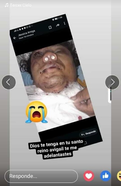 Imágen tomada de la web